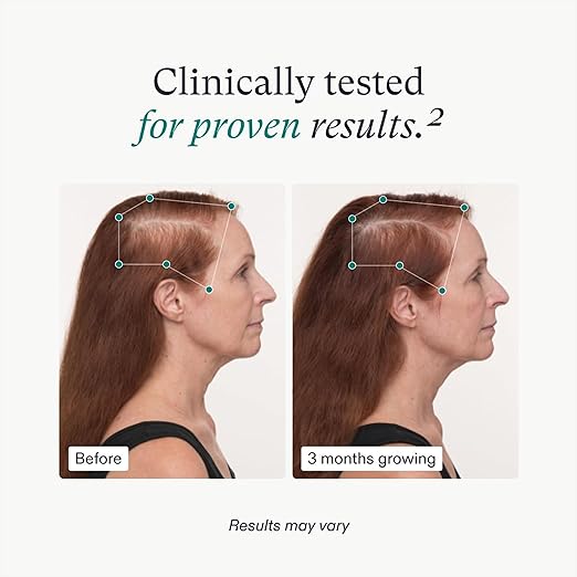 Nutrafol Women's Balance-2-Month Supply